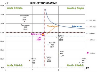 energescence bioélectronigramme