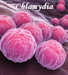 frequencetherapie chlamydia