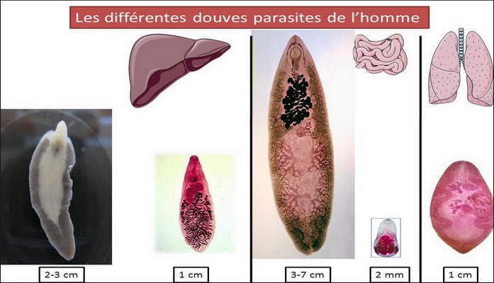 frequencethérapie douves