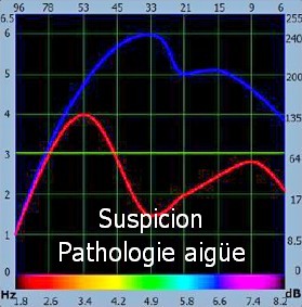 bioresonance suspicion aiigue