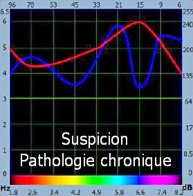 bioresonance suspicion chronique